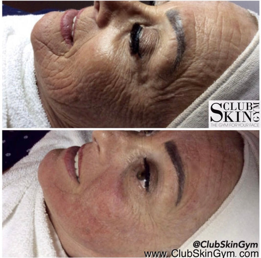 ReverseRX Anti-Aging Treatment